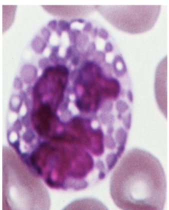 <p>What kind of granulocyte is indicated in the image?</p>