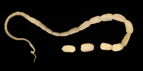 <p>Identify this parasite</p>