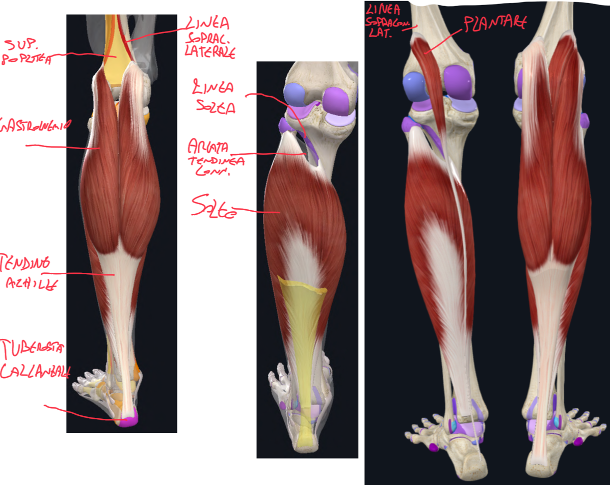 <p>Tricipite della Sura:</p><ul><li><p>Gastrocnemio</p><ul><li><p>Capo Laterale e mediale che originano dalla faccia posteriore del condilo laterale e mediale del femore</p></li><li><p>Inferiormente si uniscono formano il Tendine D’Achille (o calcaneare) che si inserisce sulla superficie posteriore del calcagno (tuberosità calcaneare)</p></li><li><p>La sporgenza del polpaccio è dovuta soprattutto a questi due capi</p></li><li><p>Clinica → In caso di rottura del tendine d’achille, il paziente non riesce ad effettuare flessione plantare</p></li></ul></li><li><p>Soleo</p><ul><li><p>Origine:</p><ul><li><p>Testa e collo della fibula,</p></li><li><p>Linea solea (o solco popliteo) della tibia</p></li><li><p>E arcata tendinea connettivale che unisce questa due sedi</p></li></ul></li><li><p>Si inserisce distalmente al tendine d’achille</p></li></ul></li></ul><p>Muscolo Plantare:</p><ul><li><p>Origine → Linea Sopracondiloidea Laterale del femore</p></li><li><p>Inserzione → faccia posteriore del calcagno accalcandosi medialmente al tendine d’achille.</p></li><li><p>Clinica → il suo tendine è molto lungo e può essere prelevato per la ricostruzione di altri tendini (es per i tendini della mano)</p></li></ul><p>FUNZIONE:</p><ul><li><p>Sono Flessori Plantari</p></li><li><p>Gastrocnemio e Plantare agiscono sia sull’articolazione del ginocchio che caviglia,</p></li><li><p>Mentre il Soleo agisce solo a livello della caviglia</p></li></ul><p></p>