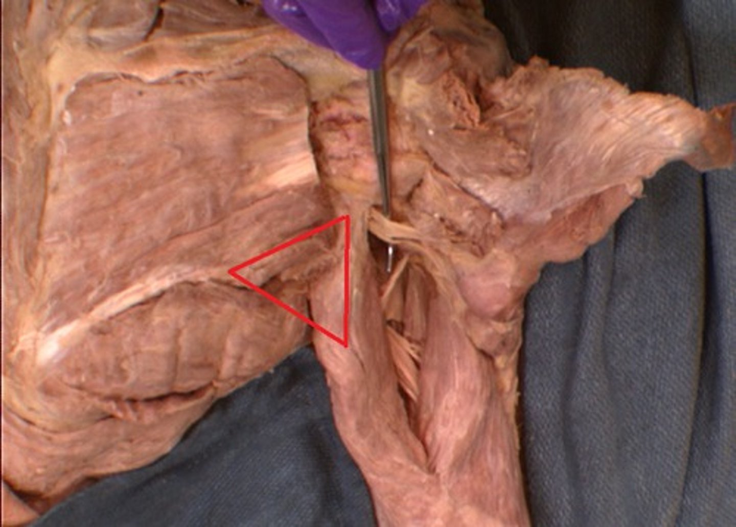 <p>long head of triceps, teres major, teres minor</p>