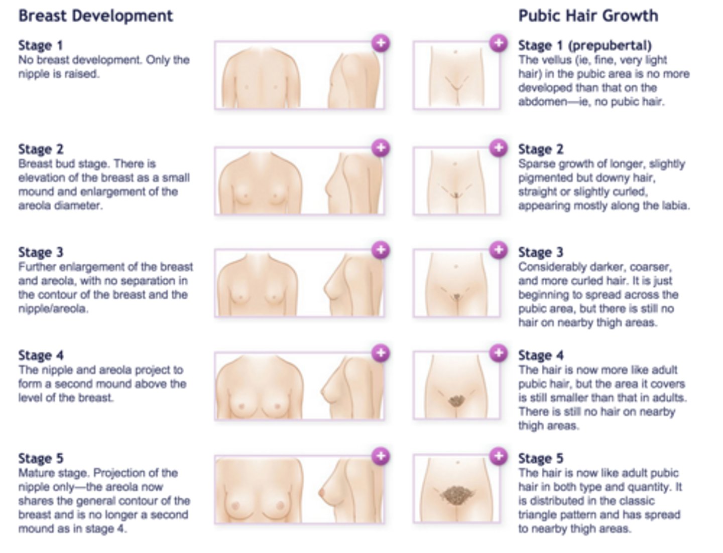<p>1. Childhood</p><p>2. Pubic hair appears (adrenarche); breasts buds</p><p>3. Pubic hair darkens and becomes curly; penis size/length increase</p><p>4. Penis width increase, darker scrotal skin, development of glans, raised areolae</p><p>5. Adult; areolae are no longer raised</p>