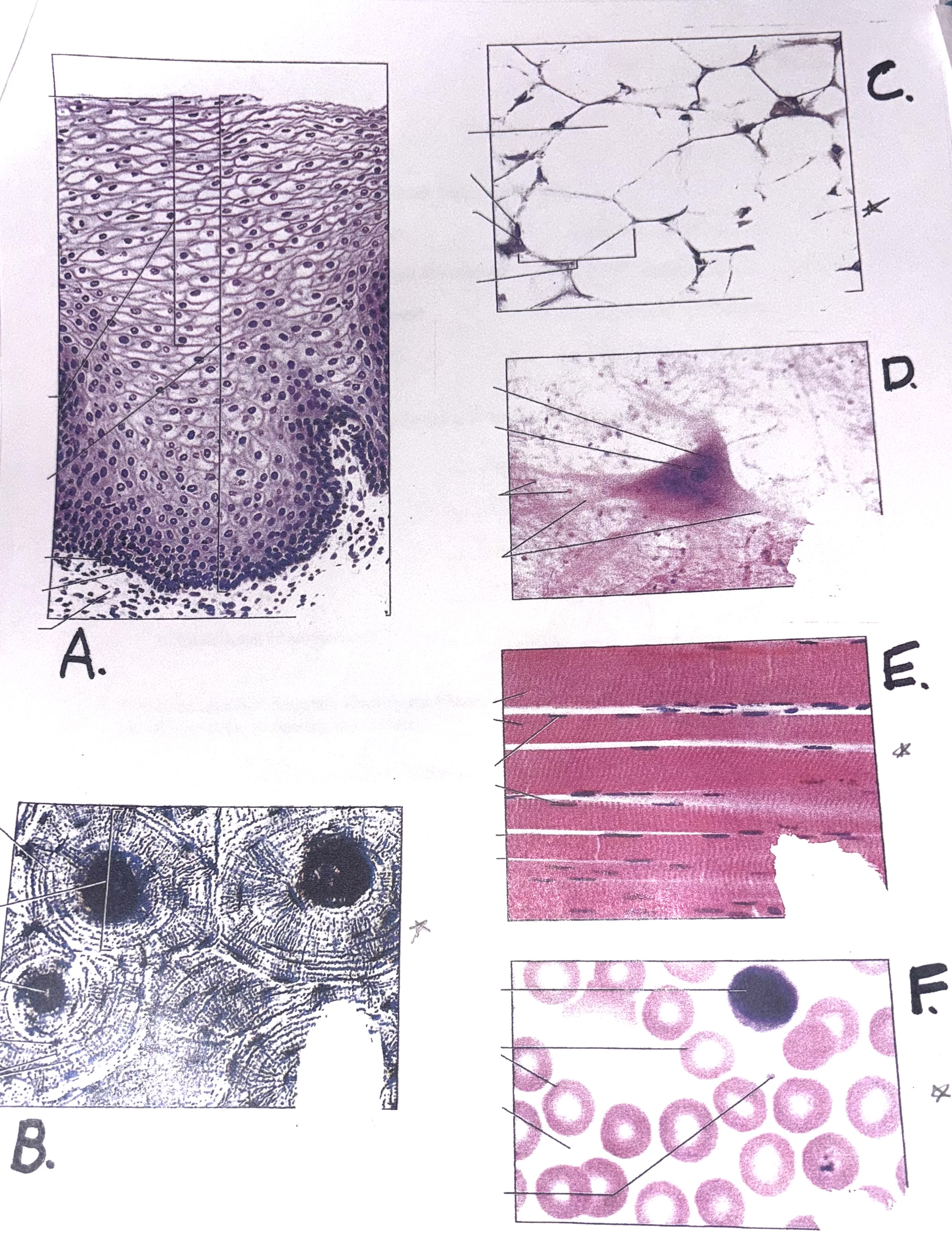 <p>Using the attached diagram, identify the tissues and write their correct names in the blanks below. Be very specific in naming the tissues.</p>