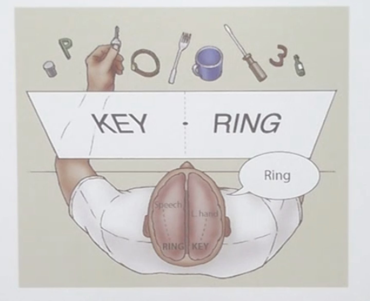 <p>When a person with a split brain is presented with the picture of a ring on the right and a key on the left side of a screen, she can verbalize ring but not key because the left hemisphere "sees" the ring and language is usually located in the left hemisphere. She would be able to choose a key with her left hand from a set of objects behind a screen. She would not, however, be able to pick out a ring with her left hand because what the left hemisphere "sees" is not communicated to the left side of her body.</p>