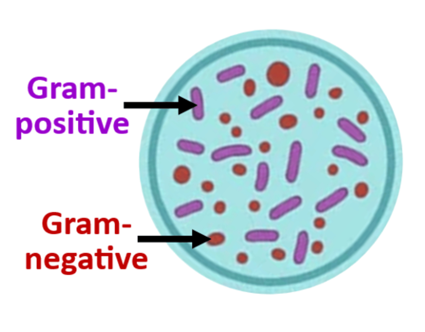 <p>a differential stain used to classify bacteria as gram-positive or gram-negative, depending on whether they retain or lose the primary stain used (crystal violet) when subjected to a decolorizing agent</p>