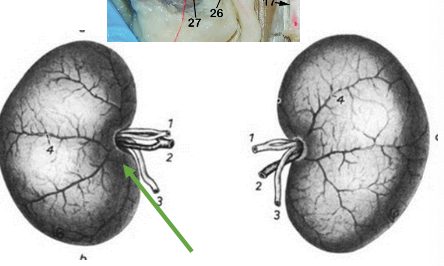 <p>What species does this kidney belong to? </p>
