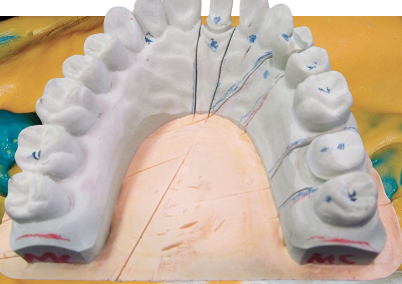 <p>What is a <strong>non-chairside</strong> optical scanner?</p>