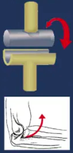 <p>allows movement within a single anatomical plane or axis of motion</p><p>e.g. elbow joint</p>