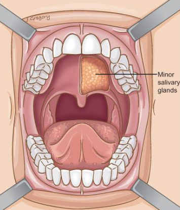 <p><span> Includes the following glands:</span></p><p><span> Palatal</span></p><p><span> Lingual</span></p><p><span> Buccal</span></p><p><span> Labial</span></p><p><span> Secrete mucous</span></p><p><span> Lubricate surfaces for improved mastication and function</span></p><p><span> Contribute fluoride to enhance caries resistance</span></p>