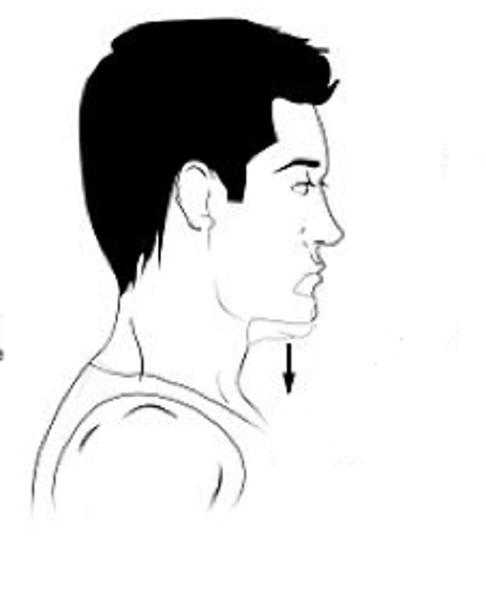 <p>Identify the action indicated by the arrow.</p>