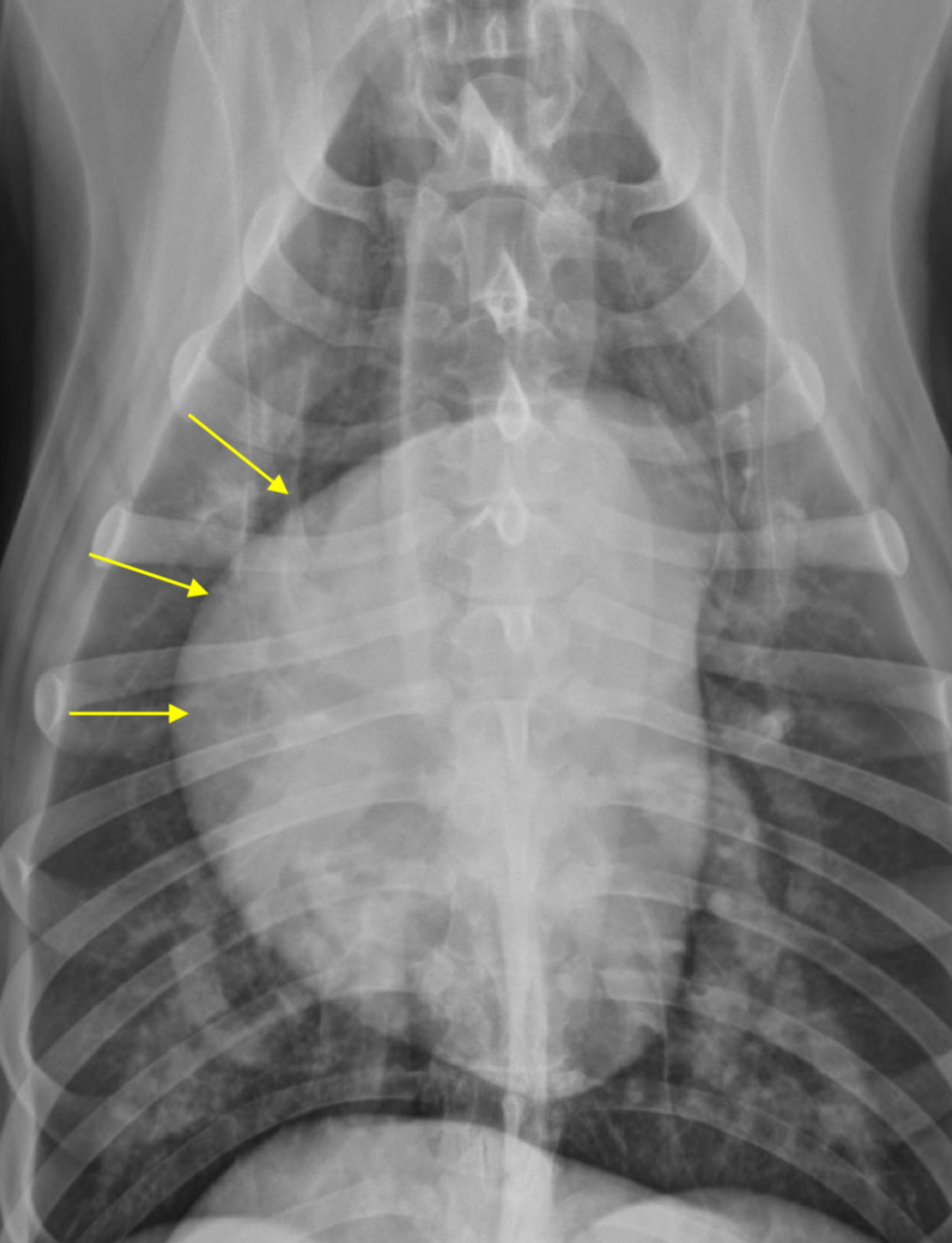 <p>Bulge at 9-11 o’clock region ± RVE bulge </p>