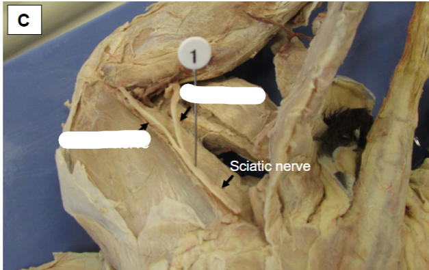 <p>______________________ nerves arise when the sciatic nerve splits in the distal part of the thigh</p>