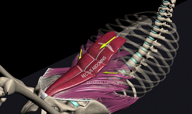 <p>Function: spinal flexion</p><p>Origin: pubic symphysis</p><p>Insertion:&nbsp;costal cartilage &amp; sternum</p>