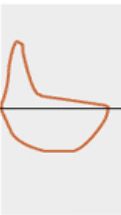 <p>what is this flow volume loop showing </p>