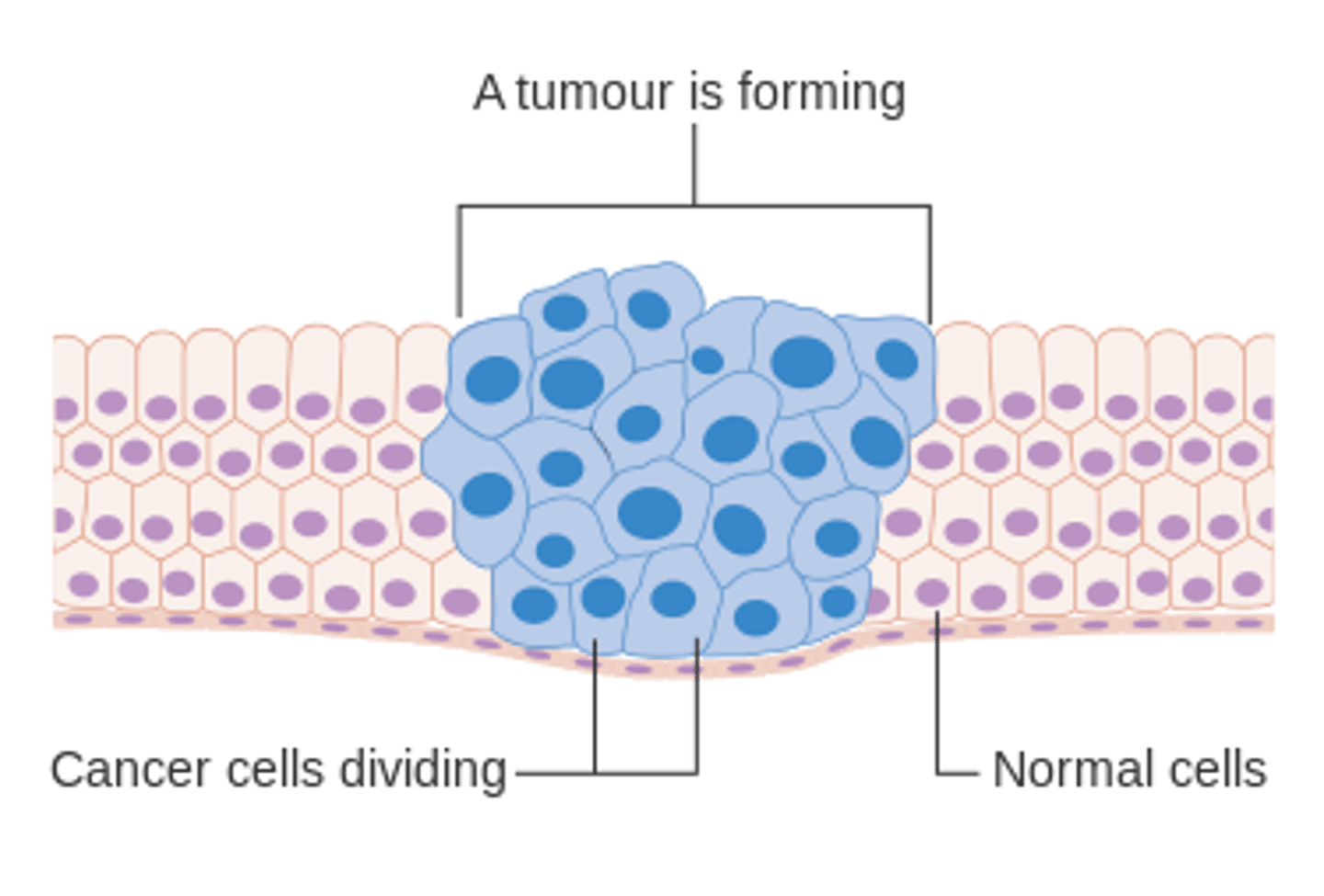 <p>A Neoplasm is an abnormal growth of tissue, which when it forms into a mass, it will then be referred to as a Tumor.</p>