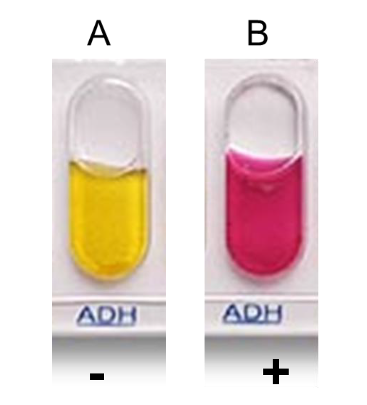 <p>Arginine Dehydrolase</p><p>Determines whether bacteria can express arginine dehydrolase or not.</p><p></p>