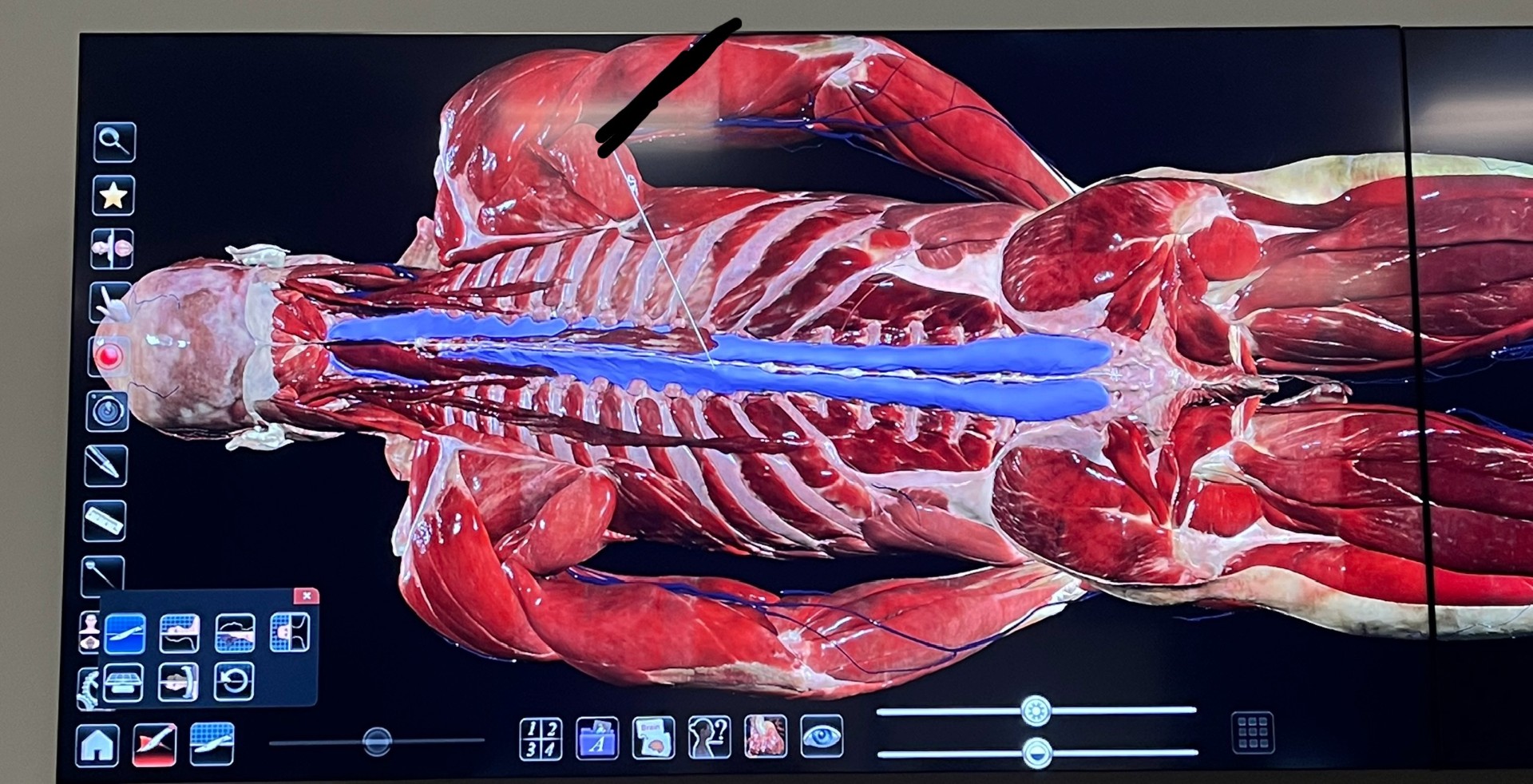 <p>What spinal muscle is this</p>