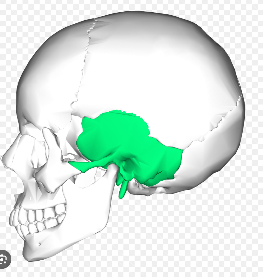 <p>Temporal bone (right and left)</p>