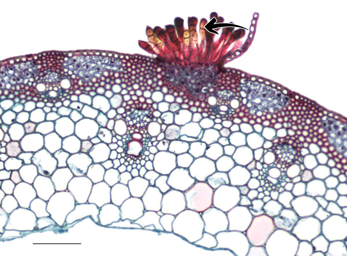 <p>Puccinia graminis: Vad indikerar pilen på för struktur + spor?</p>