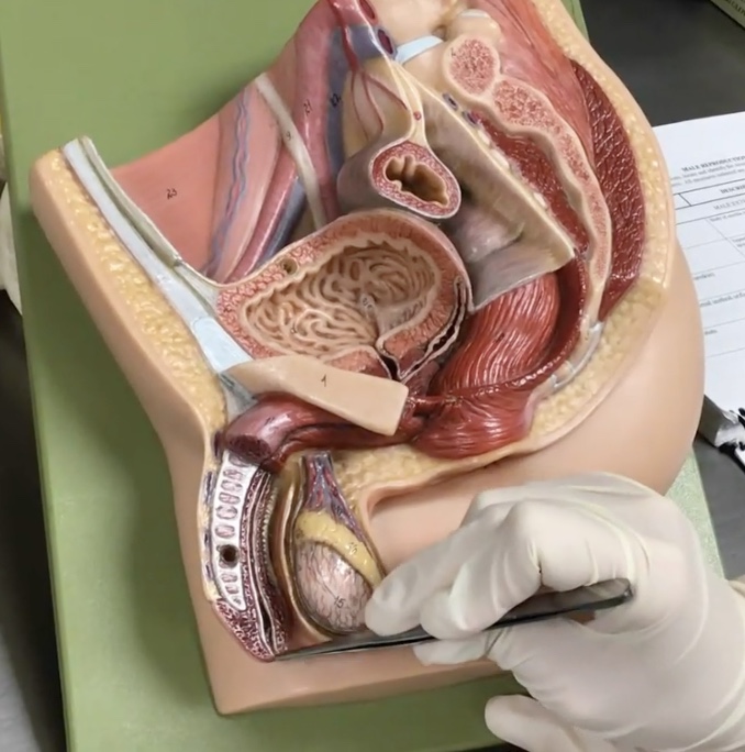 <p>Description: Opening of the urethra in the glans penis</p><p>Relationship: N/A</p>