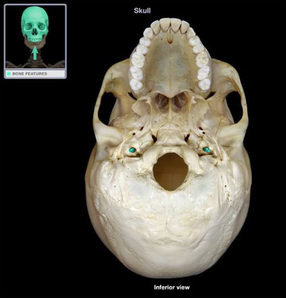 <p>Hole on the inferior surface of petrous part anterior to jugular</p>