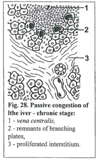 <p><strong>Chronic passive hyperemia of liver</strong></p><img src="https://knowt-user-attachments.s3.amazonaws.com/ebb04d55-3801-416e-820b-bcbeb98b0f14.png" data-width="100%" data-align="center"><p></p>