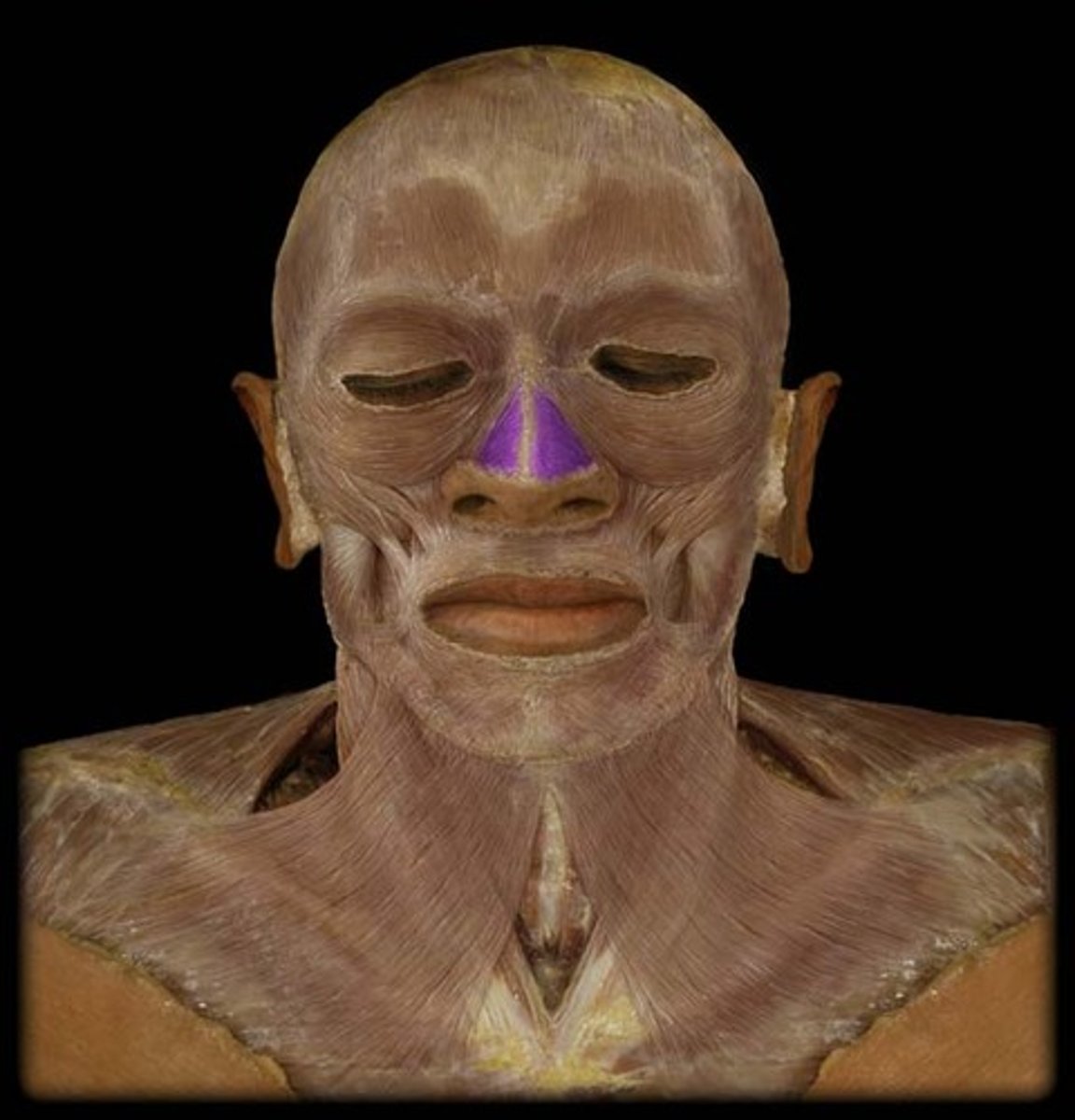 <p>ID muscle</p><p>- flares nostrils</p>