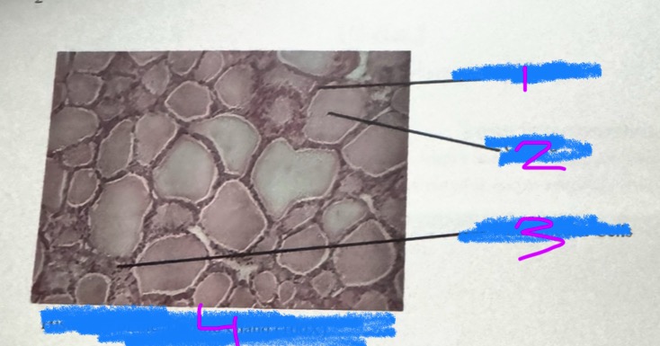 <p>What is this an image of? (4) </p>
