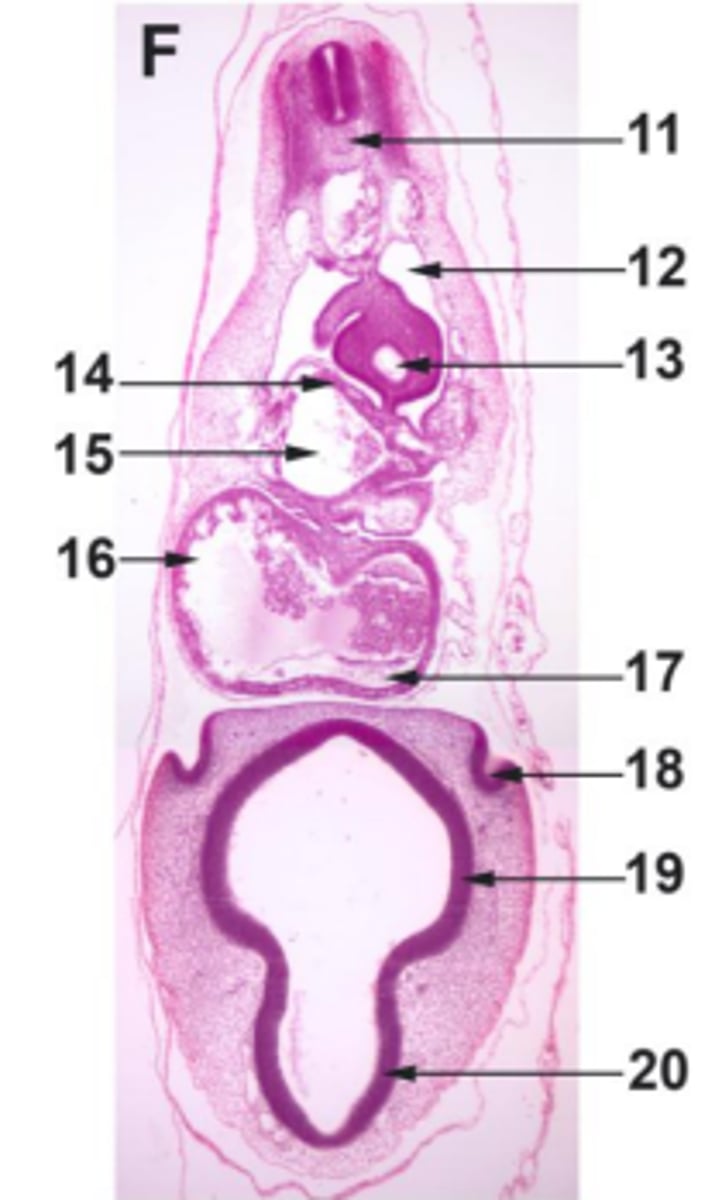 <p>#11ectoderm</p>