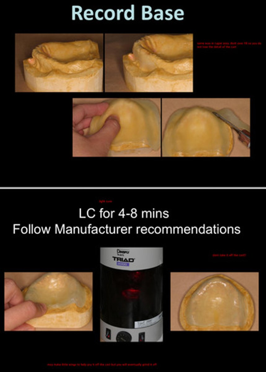 <p>4-8 minutes; but follow manufacturer recommendations</p><p>note: do not take the record base off the cast while curing as it may warp</p>