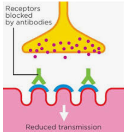 <p>-myasthenia gravis (25-30%)</p><p>-polymyositis/polymyopathies</p><p>-hypoadrenocorticism (Addison’s)</p><p>-hypothyroidism</p><p>-thymoma (paraneoplastic)</p><p>-dysautonomia (cats>dogs)</p><p>-lead poisoning</p><p>-chronic esophageal disease</p>