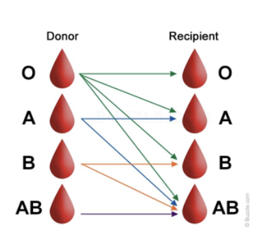 <ul><li><p>Type O-</p></li><li><p>No RBC antigens</p></li><li><p>Donor’s plasma may have both antibodies against recipient’s RBCs (anti-A, anti-B, anti-Rh)</p></li><li><p>May give packed cells  (minimal plasma)</p><ul><li><p>we separate blood plasma and blood cells to separate antibodies</p></li></ul></li></ul><p></p>