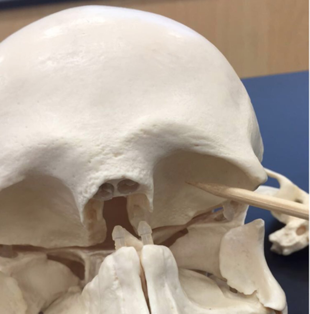 knowt flashcard image