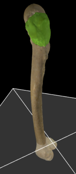 <p>Knobbel lateraal van de bovenzijde van het collum.</p>