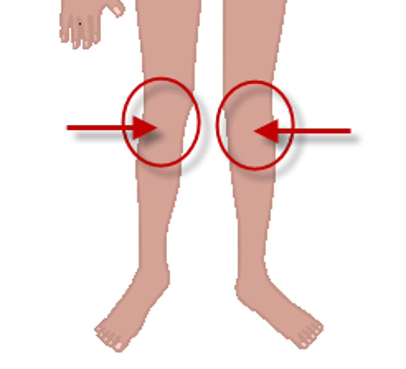<p>the knee, knees</p>