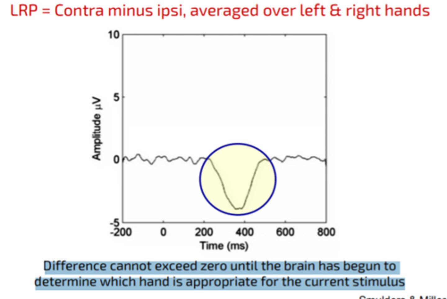 <p>an event-related brain potential that is thought to reflect the preparation of motor activity on a certain side of the body; in other words, it is a spike in the electrical activity of the brain that happens when a person gets ready to move one arm, leg, or foot</p>