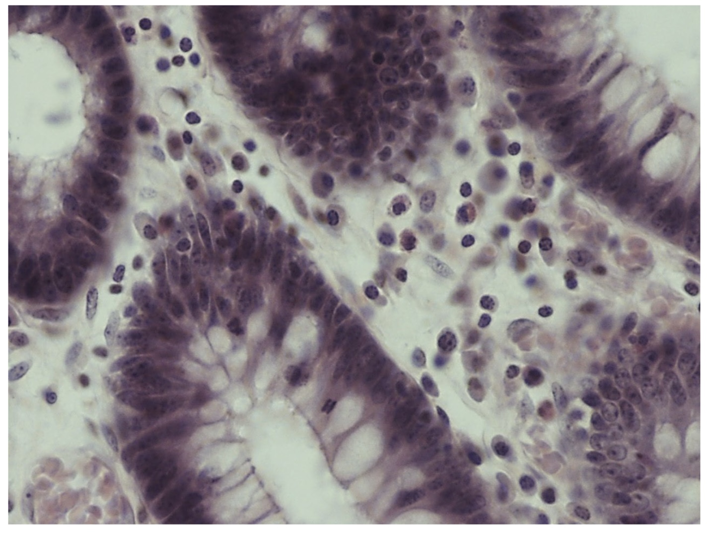 <p>ID as many cell types as you can </p>