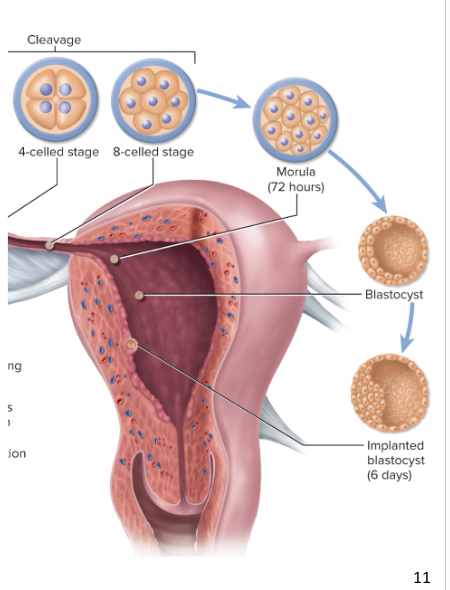 <p>a hollow sphere</p><ul><li><p>made up of the trophoblast and embryoblast</p></li><li><p><span style="background-color: transparent;"><span> is what actually implants in the lining of endometrium</span></span></p></li><li><p><span style="background-color: transparent;"><span>attaches to uterine wall 6 days after ovulation</span></span></p><ul><li><p><span style="background-color: transparent;"><span>Usually on the fundus or posterior wall of the uterus</span></span></p></li></ul></li></ul><p></p>