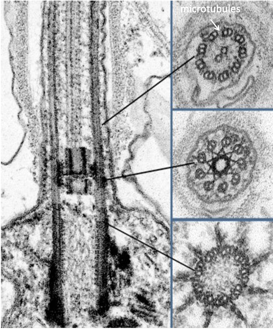 <ul><li><p>features</p></li><li><p>Whip-like structures projecting from the <strong>cell surface​</strong></p></li><li><p>Contain a <strong>ring of nine double microtubules + 2 central ones​</strong></p></li><li><p>Flagella are larger, and only one is present, cilia are smaller and many are present​</p></li><li><p>Have <strong>microtubules inside</strong></p></li></ul><p></p><ul><li><p>functions</p></li><li><p>Cilia <strong>move liquid over surfaces</strong> (e.g. particle-laden mucus towards throat)</p></li><li><p>For <strong>movement </strong>(sperm cells)</p></li></ul><p></p>