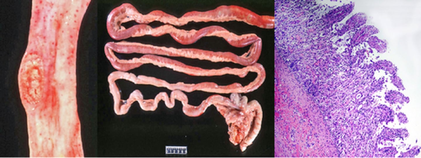 <p>✔ CPV-2 is the canine counterpart, derived from feline panleukopenia virus.</p><p>💉 Family: Parvoviridae</p><p>Systems affected: Gastrointestinal, hematopoietic, cardiac (puppies)</p><p>⚠️Clinical signs (CPV-2): Hemorrhagic diarrhea, vomiting, dehydration, leukopenia, myocarditis in puppies</p><p>🔬Histopathology: Intestinal crypt necrosis, villus atrophy, intranuclear inclusions</p>