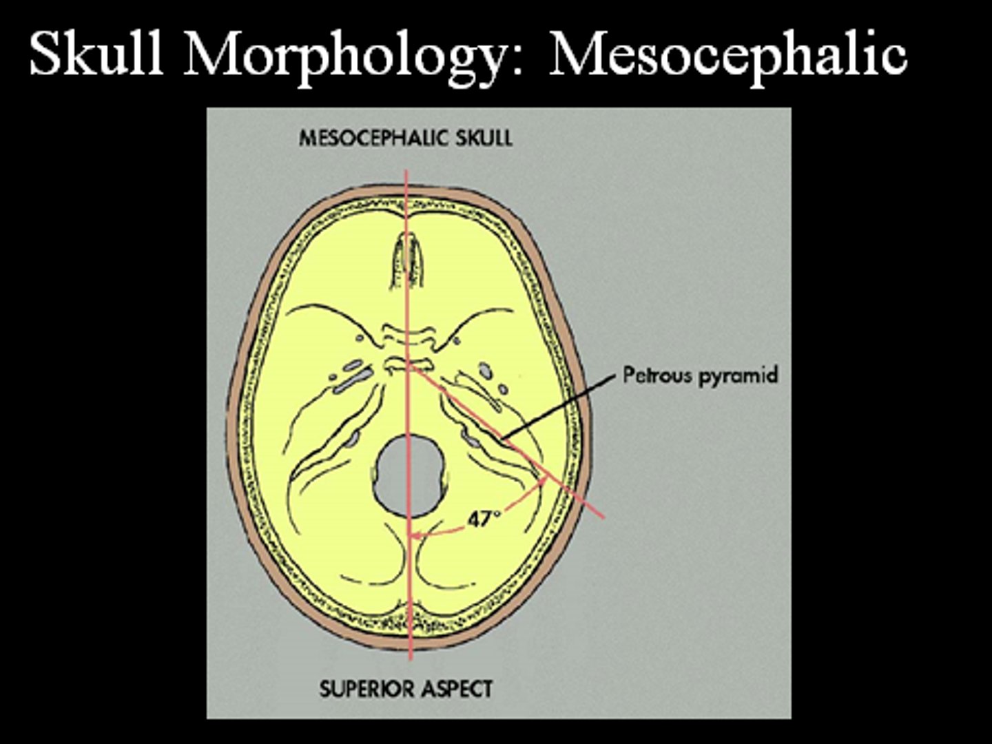 <p>Width between 75% &amp; 80% of length</p><p>(15cm between parietal eminences; 19cm from frontal eminence to external occipital protuberance; 23 cm from vertex to beneath the chin)</p>