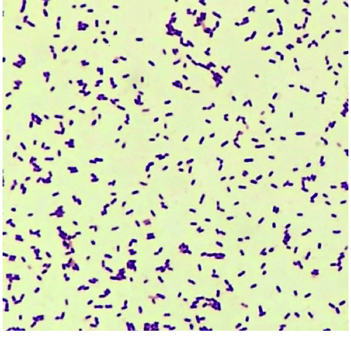 Listeria monocytogenes