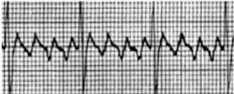 <p>What rhythm is this?</p>