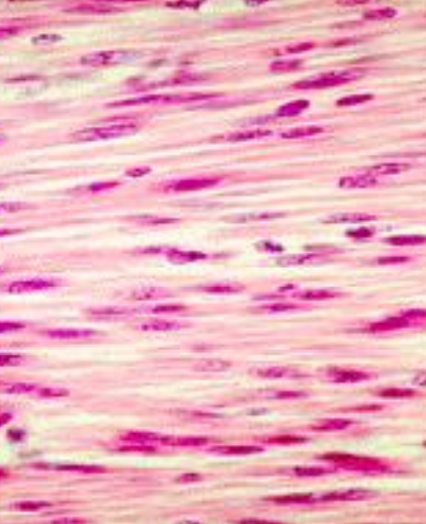 <p>What muscle is this?</p>