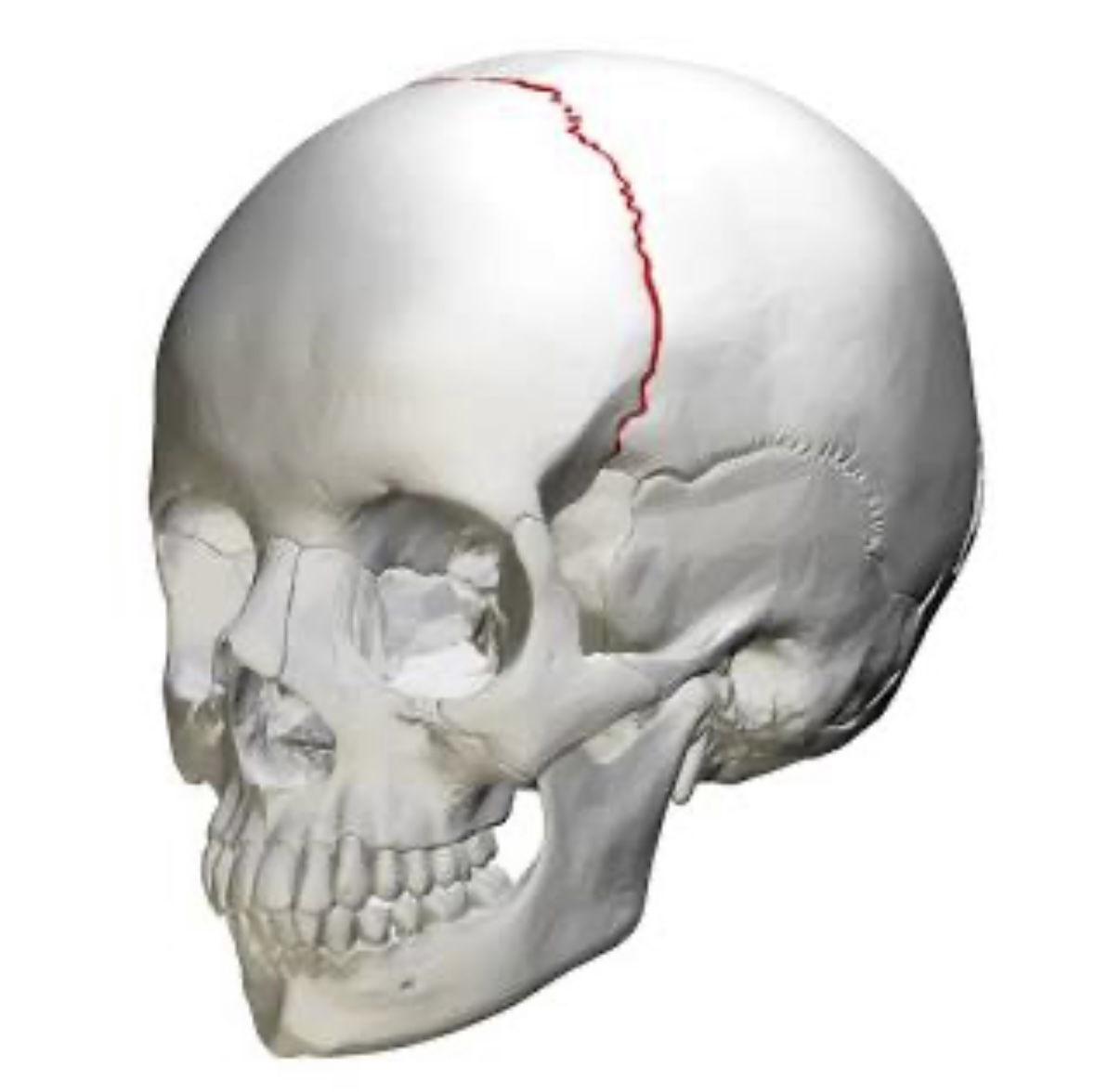 term image
