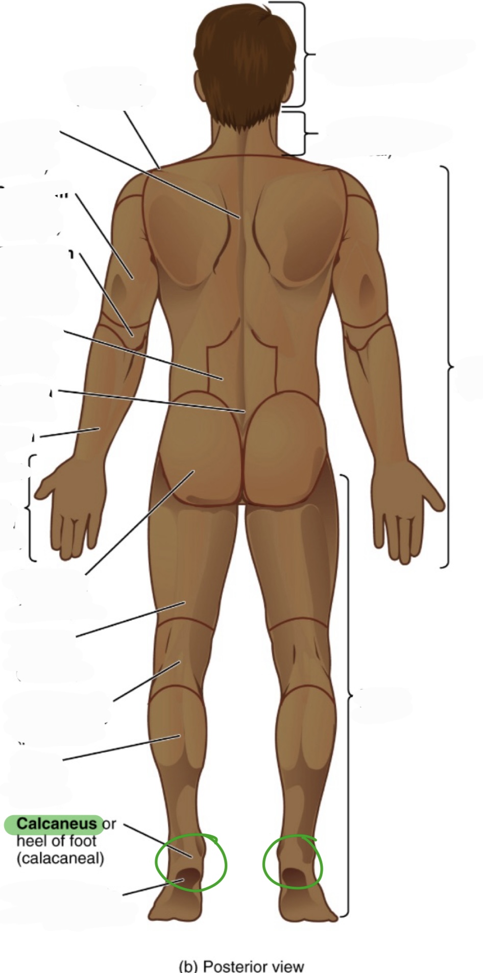 <p>heel of the foot</p><p>(aka calacaneal)</p>
