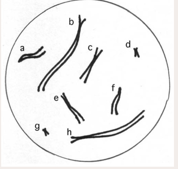 <p>Which pairs of chromosomes in this cell are homologous? (In this drawing, the letters don't refer to alleles--they are just labels for the chromosomes that are shown.)</p>
