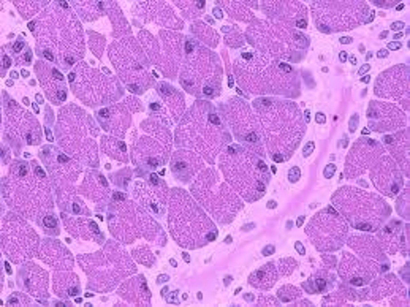 <p>enzyme-secreting cells of the pancreas; apical nuclei</p>