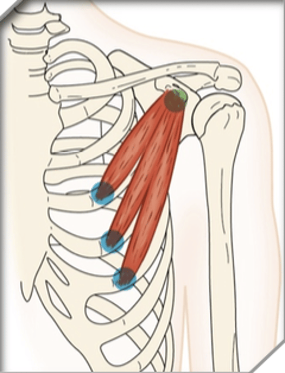 <p>What muscle is this?</p>