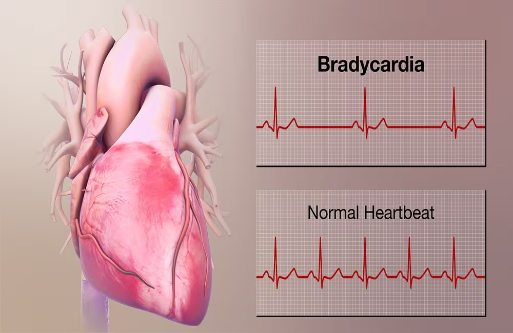 <p><strong>Definition of Prefix</strong></p><ul><li><p>b r a d y c a r d i a</p></li></ul><p>A. fast<br>B. slow<br>C. quickly<br>D. sudden</p>