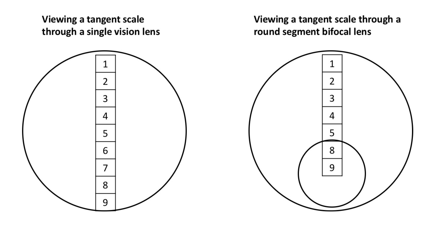 <p>Describe the sudden change in prismatic effect across the transition between the distance portion and the near segment of a bifocal </p><p>It can produce disturbing effects fir the pt where the image of an object moves suddenly as it crosses into or out the segment </p><p>Segment gives base down prism causing image to move upwards to top of segment </p><p>A consequence of this is a loss of visual field at the top of the segment </p>